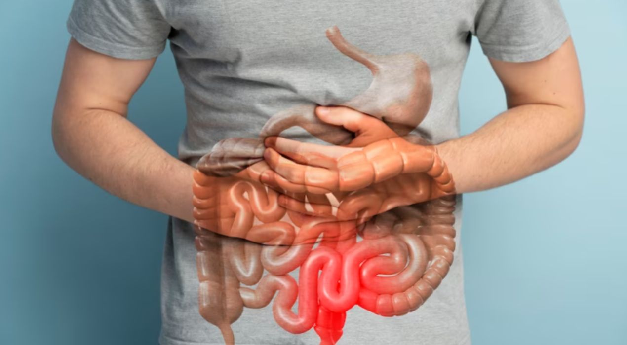 اسباب الامساك المزمن: التعريف والعوامل المؤثرة