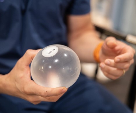  انواع بالون المعدة