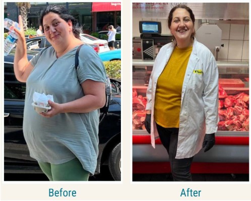 اسباب فشل بالون المعدة