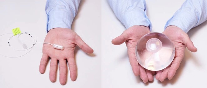 الفرق بين الكبسولة الذكية وبالون المعدة