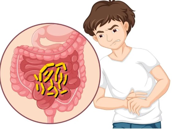 أعراض واسباب جرثومة المعدة