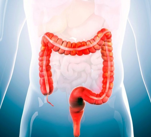 علاج القولون العصبي