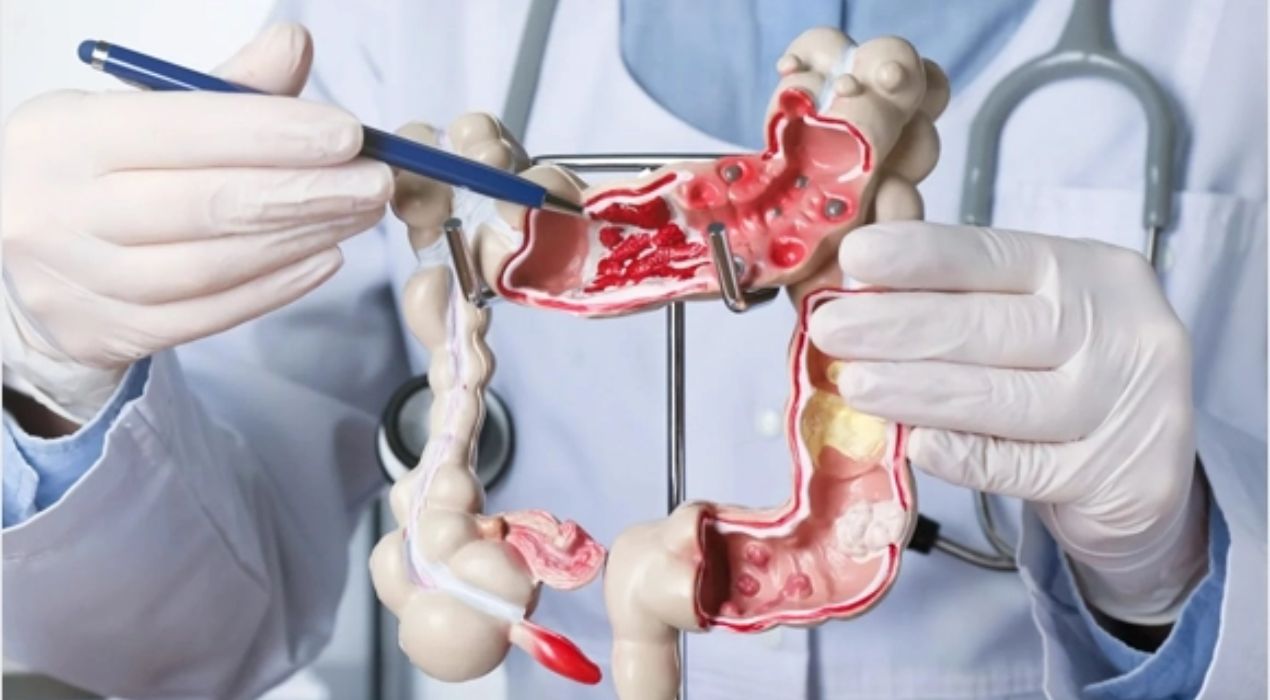 افضل دكتور قولون عصبي في الكويت وأحدث طرق العلاج 2026