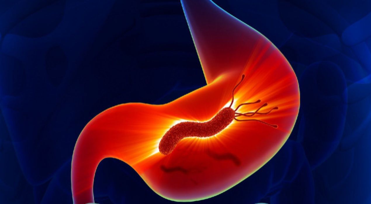 أعراض جرثومة المعدة