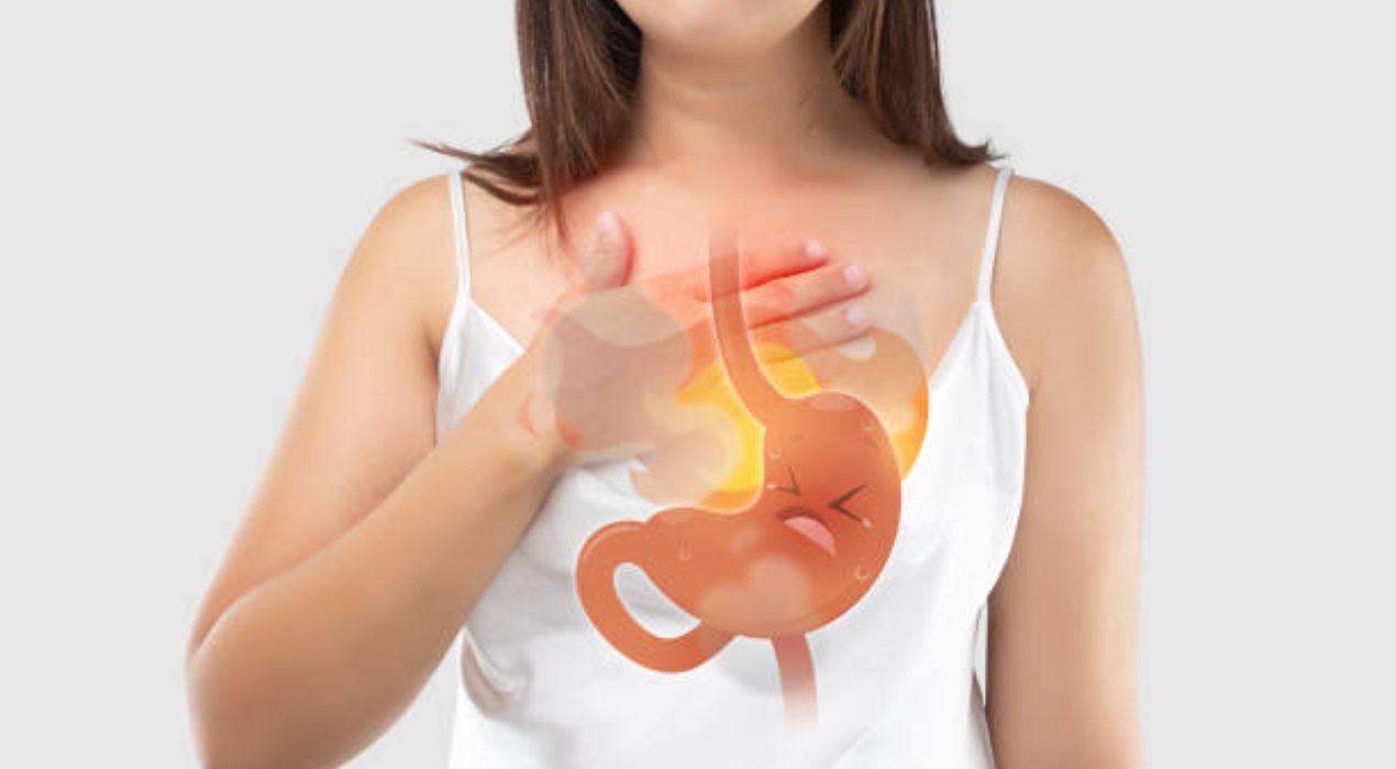 أسباب ارتجاع المرئ 2026 | دليلك للأسباب والأعراض وطرق الوقاية