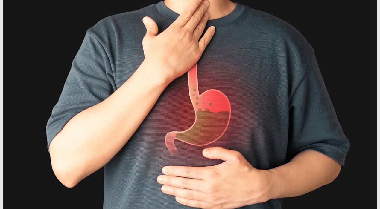 تعرف علي مضاعفات ارتجاع المرئ واعراضه الاكثر خطورة في الكويت