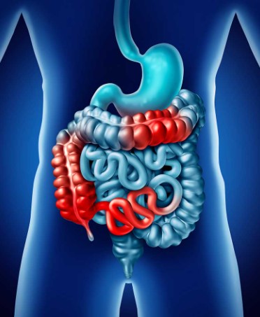 اسباب انتفاخ القولون