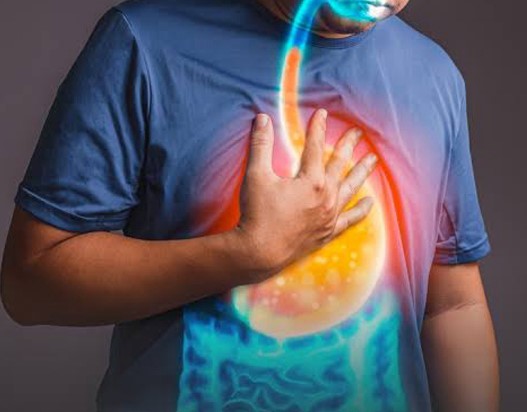 أسباب ارتجاع المرئ