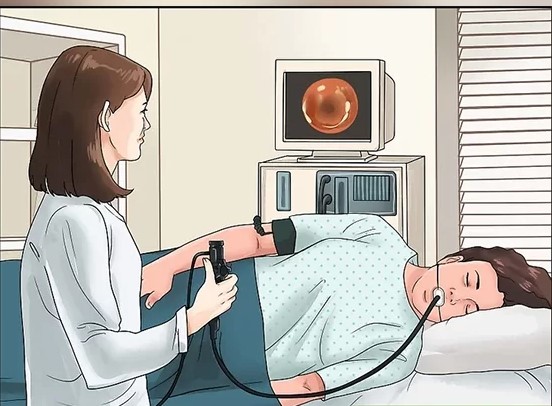 منظار المعدة