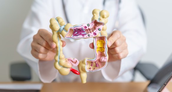 أعراض زوائد لحمية في القولون