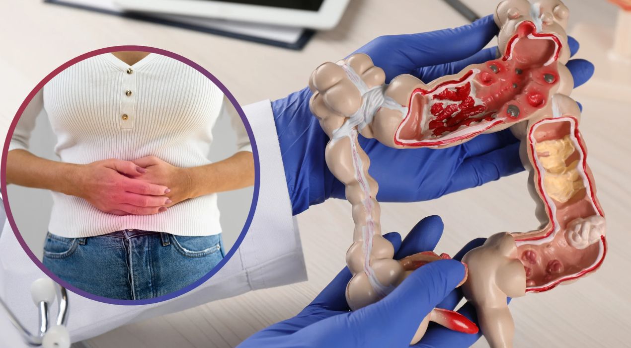 أعراض سرطان القولون 2026 | تعرف دليلك لأهم العلامات المبكرة