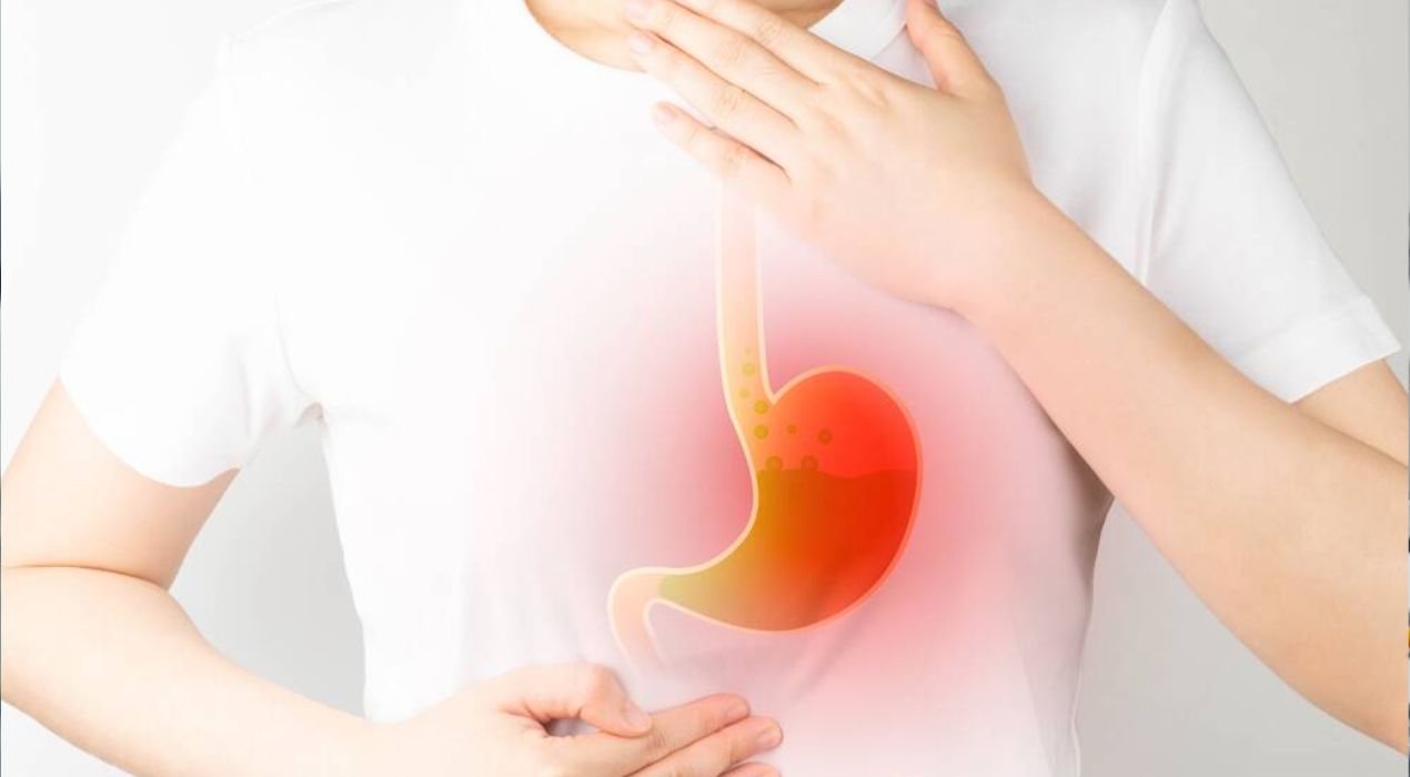 تعرف علي اسباب حموضة المعدة وكيفية التعامل معها 2026