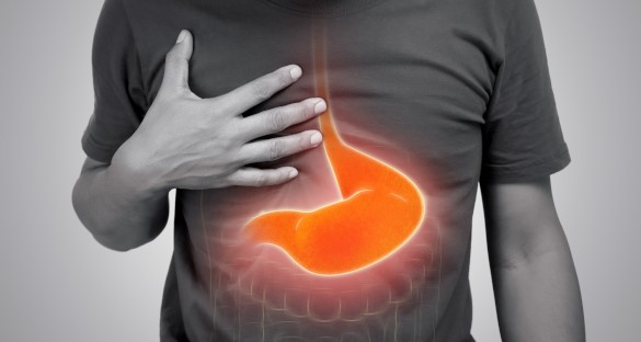 اسباب حموضة المعدة