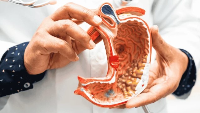 اسباب سرطان المعدة