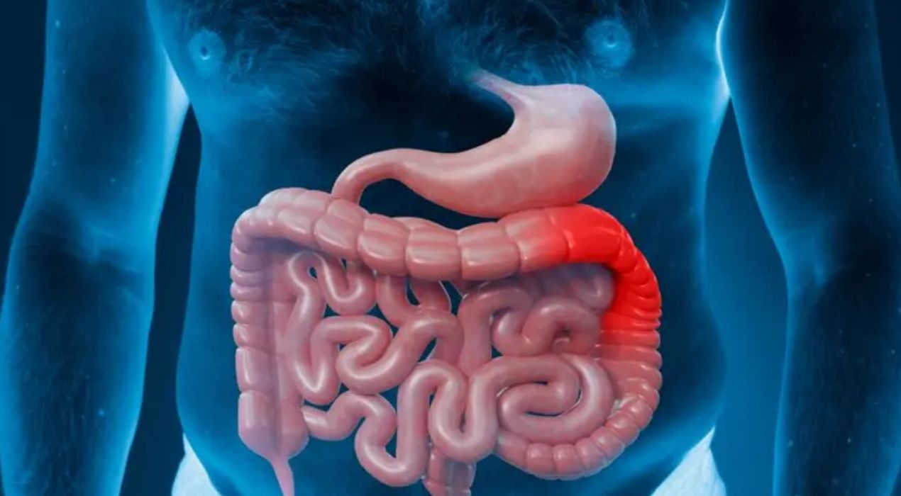 ما هو التهاب القولون؟ الأعراض الشائعة ومتى يكون خطيرًا 2026