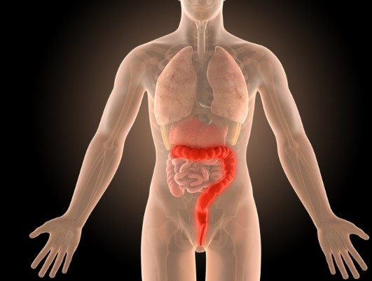 ما هو التهاب القولون 