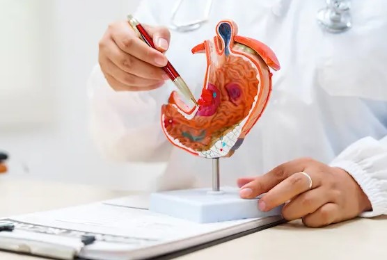 ما هو الفرق بين قرحة المعدة والتهاب المعدة؟