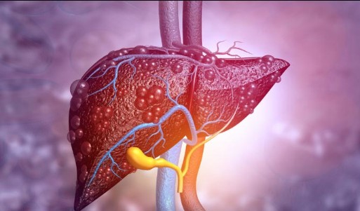 اعراض ارتفاع انزيمات الكبد