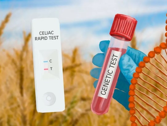 مرض السيلياك