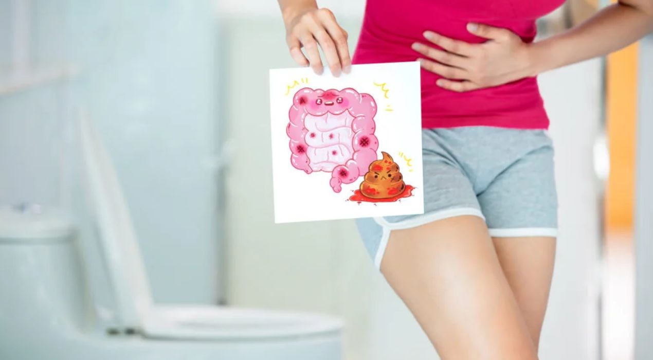 دليلك حول اهم 8 اسباب وجود دم في البراز ،ومتي تكون خطيرة؟