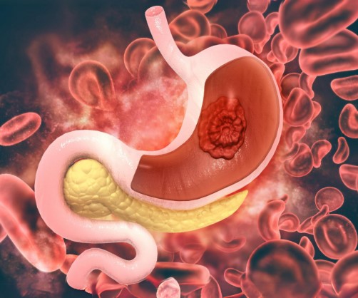  اسباب لحمية المعدة