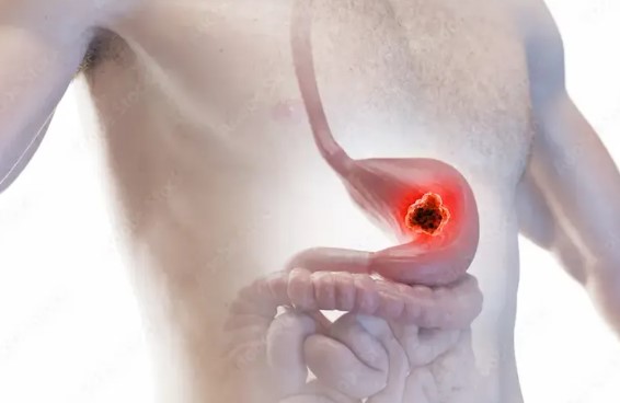  اسباب لحمية المعدة