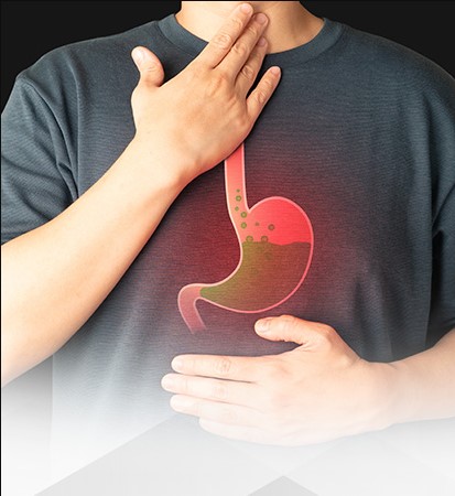 انواع ارتجاع المرئ