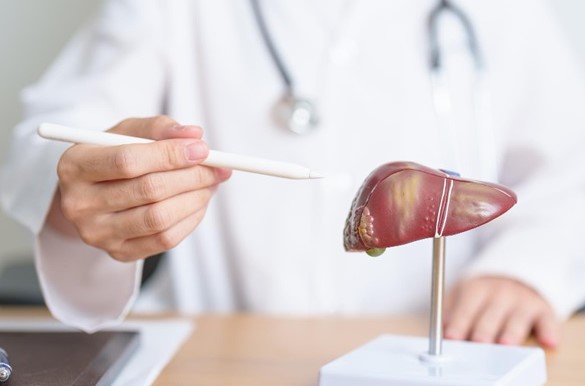 علاج الكبد الدهني