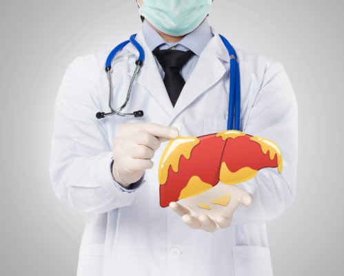 علاج الكبد الدهني