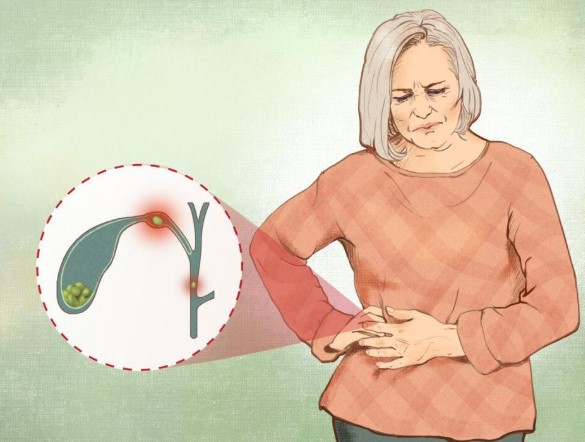 اعراض التهاب المرارة