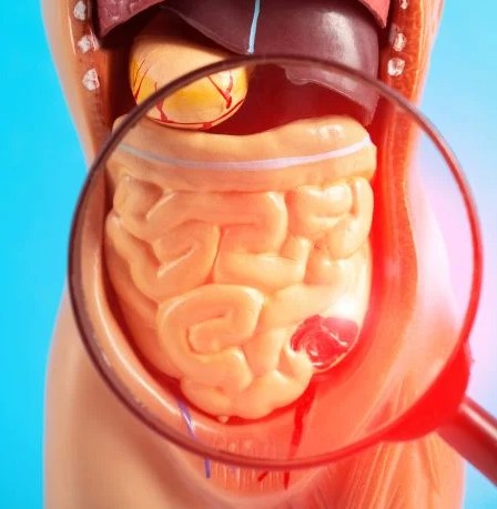 علاج خروج المخاط في البراز