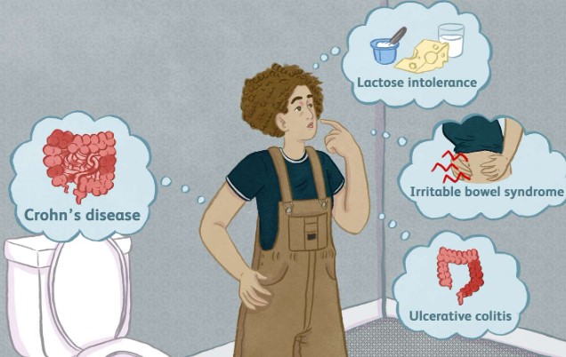 اسباب خروج مخاط مع البراز