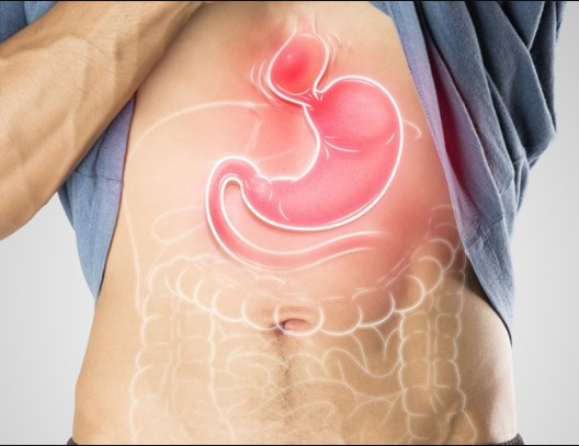 تشخيص فتق الحجاب الحاجز