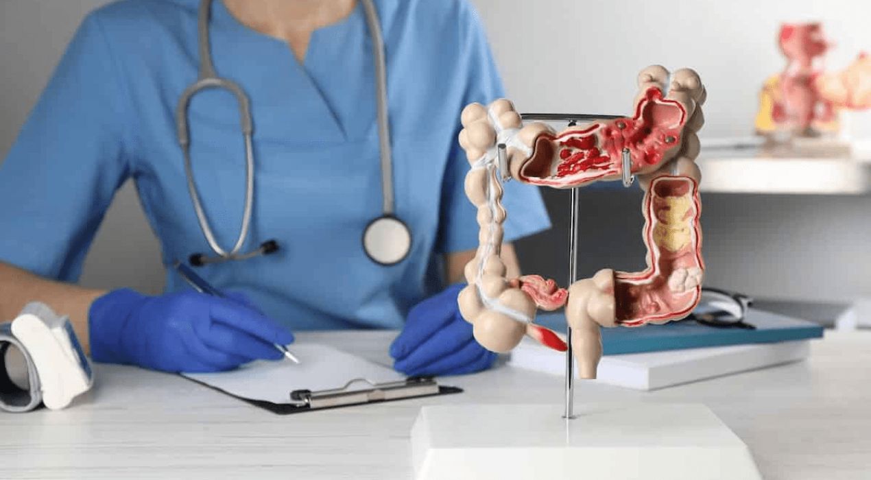 تعرف علي طرق علاج خروج المخاط في البراز وكيفية التشخيص