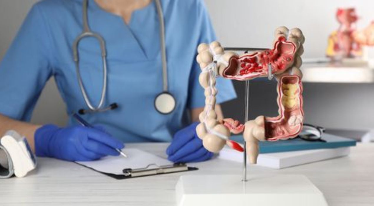 دليلك الشامل حول طرق الوقاية من سرطان القولون مع النصائح