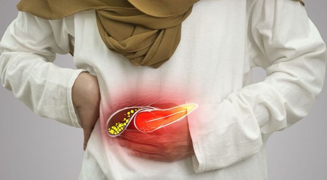 كل ما تريد معرفته عن حصوات المرارة واعراضها واسبابها والعلاج