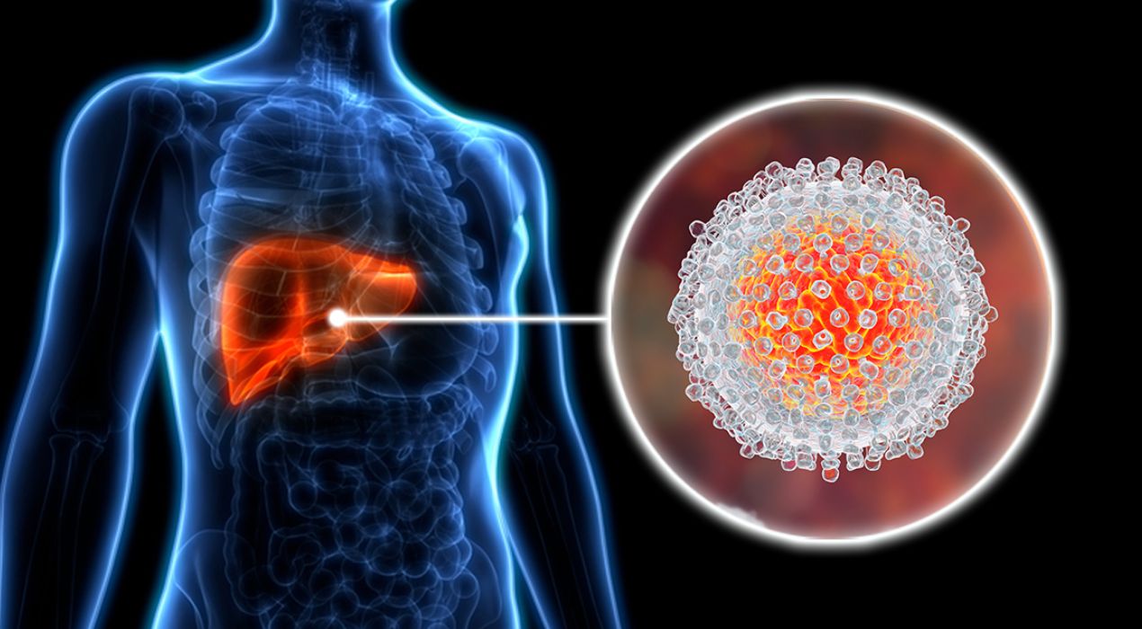 دليلك الشامل عن اسباب التهاب الكبد الفيروسي وطرق علاجه 2026
