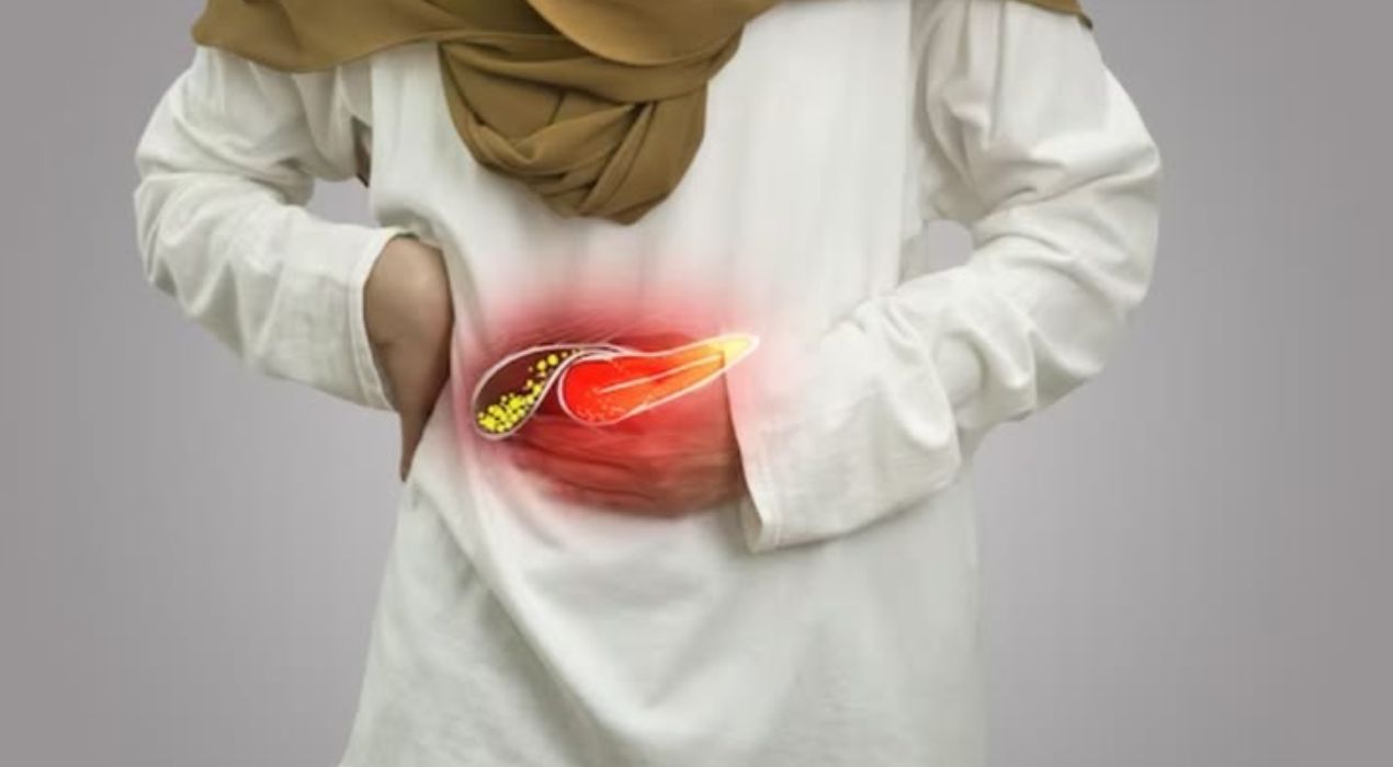 علاج حصوات المرارة: تعرف على أفضل الطرق الطبية والطبيعية 2026