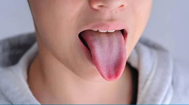 اسباب صعوبة البلع