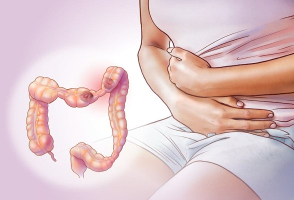 أعراض انسداد الأمعاء